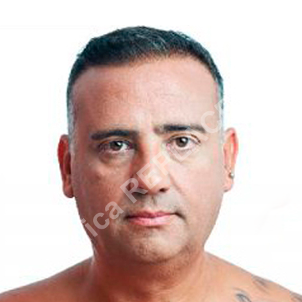 Depois